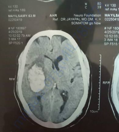 Scan report.