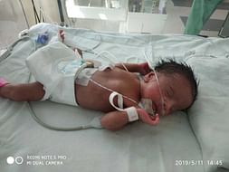 Help Premature Daughter Recover