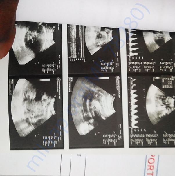 Medical Report