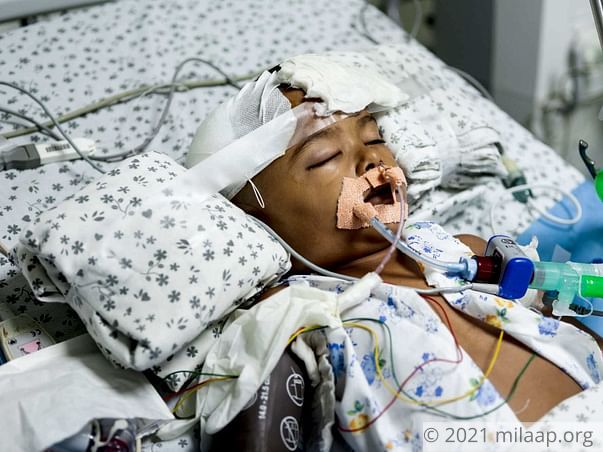 Help Aradhya Undergo Decompressive Craniotomy