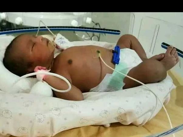 Support Baby Madhu Recover From Intestinal Problems