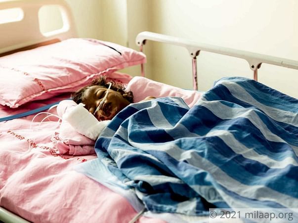 Accidental Fire Has Left This Baby’s Body And Face Completely Burnt