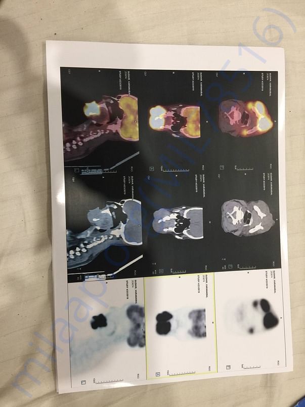 Scan report