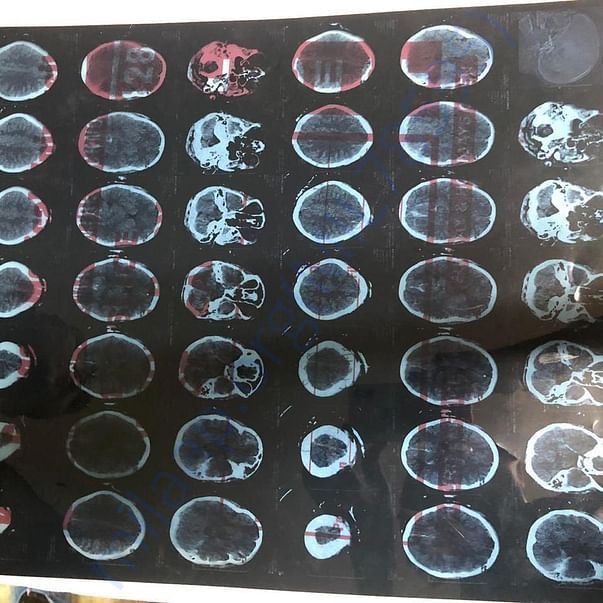 Medical Report