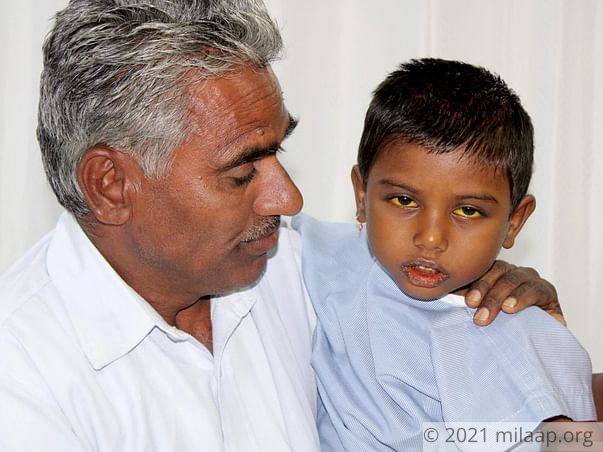 Srishanth needs your help to undergo Liver transplant