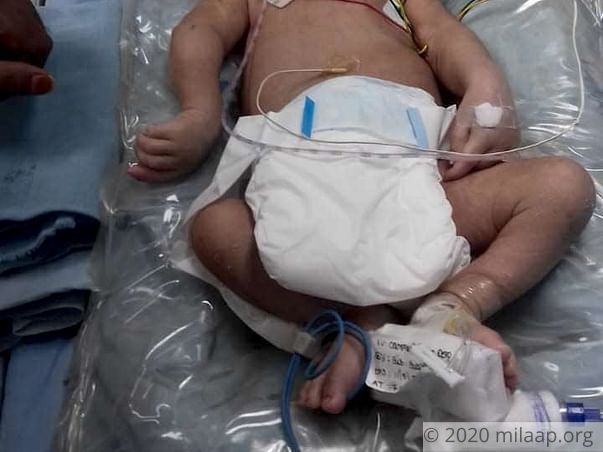 Help Baby Of Swetha Recover