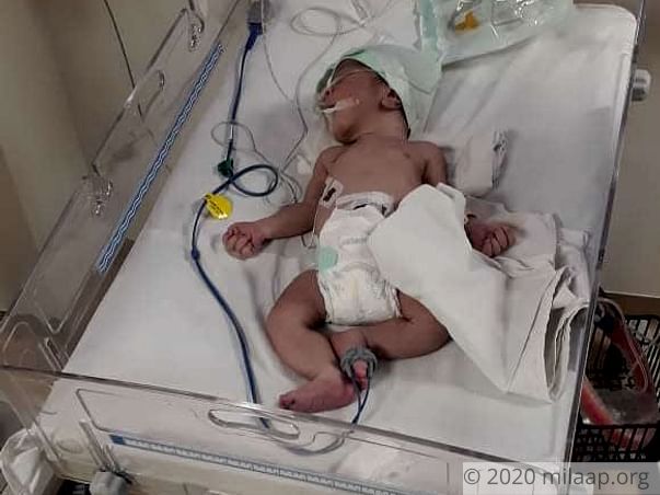 Baby of Asha needs your help to survive