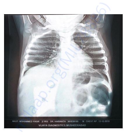 Xray report.
