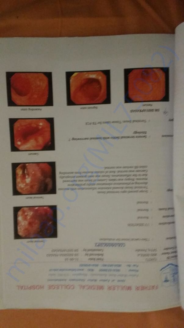 Estimation,petcity,Biopsy,Discharge Summery