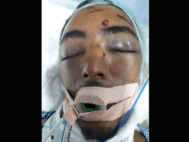 Help Mohamed Zabi Recover From An Accident