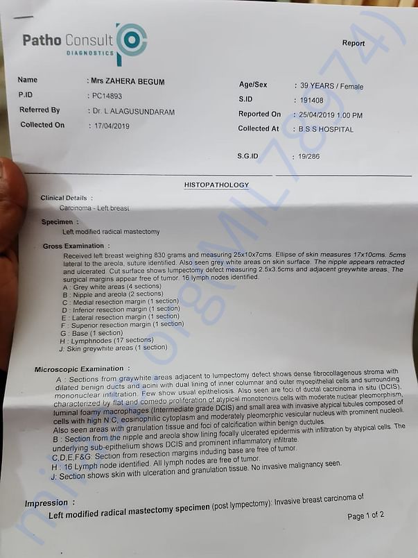 Breast cancer confirm report