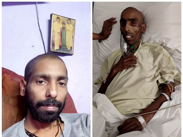 Parmeet Kumar wants to live for his 4.5yrs old son and his wife!