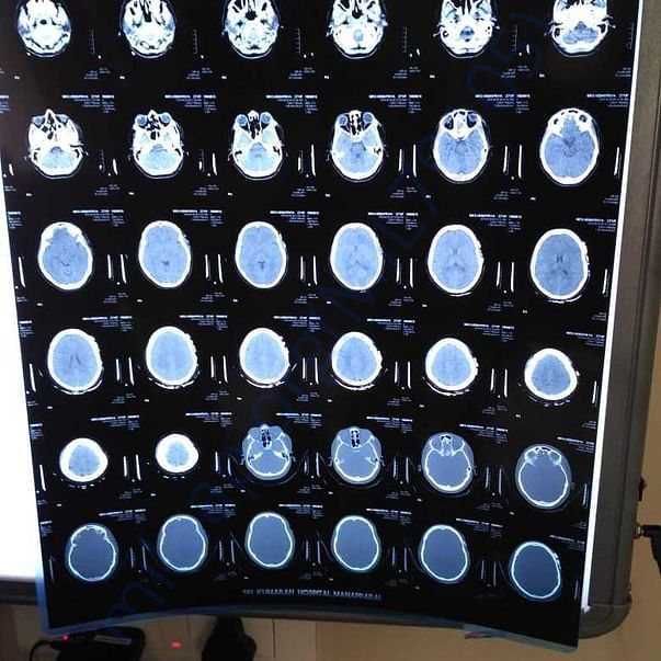 Medical Report