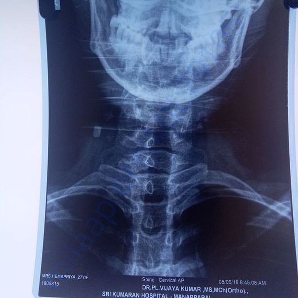 Medical Bill