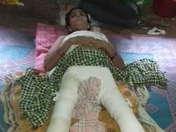 Help My friend's Mother to Recover from Severe Hip Injury