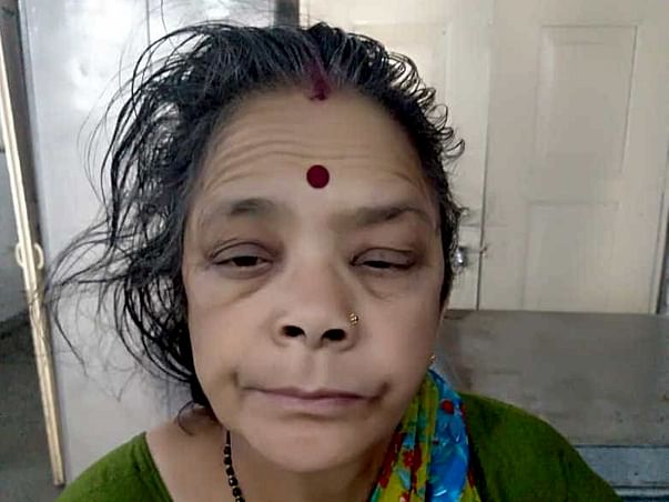 Help Bimla Undergo Heart And Kidney Treatment