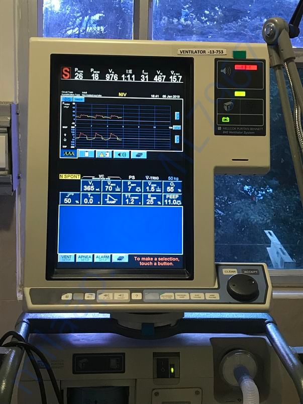 In ICU