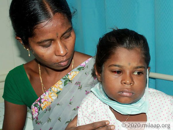 Baby Govindamma needs your help to undergo treatment