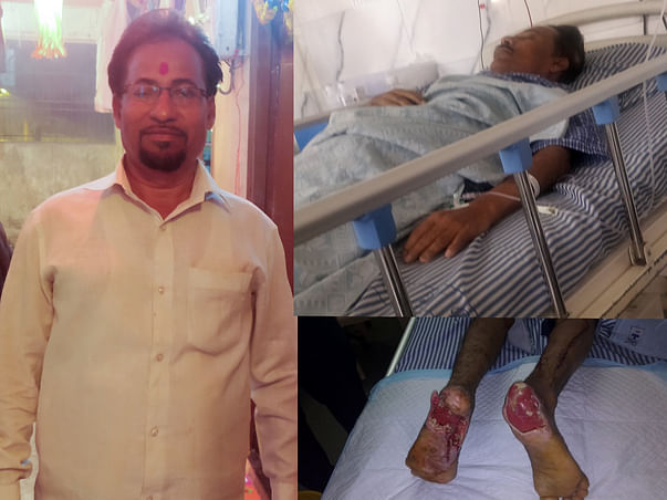 Help to raise fund for my father's both heels plastic surgery