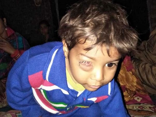 Support 2 Year Old Mohd. Saad Fighting With Cell Tumor On His Eye