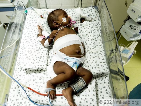 Baby of Naga Lakshmi needs your help to survive