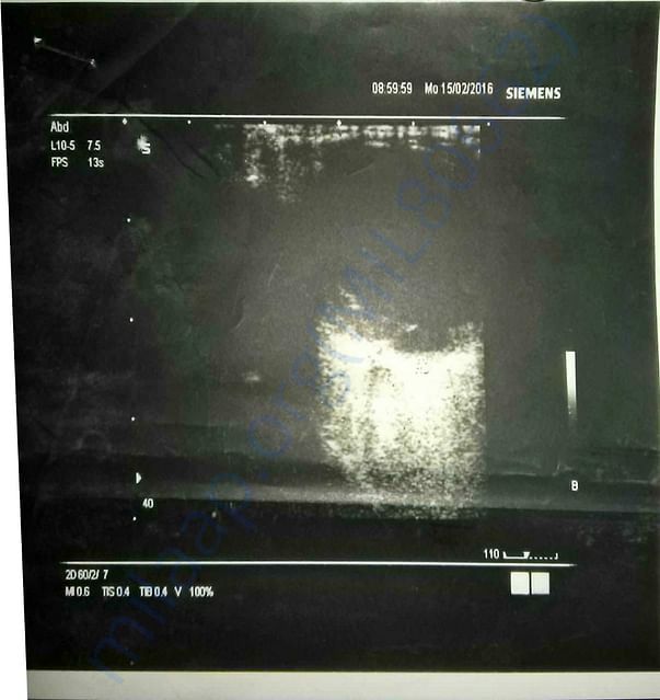 Xray report