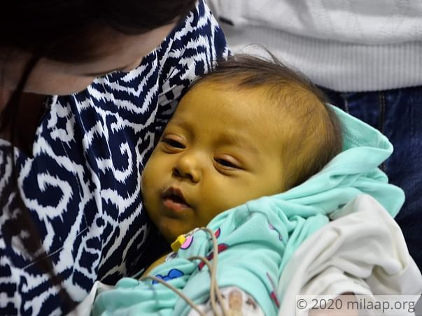 Baby Rukhsorabonu needs your help urgently