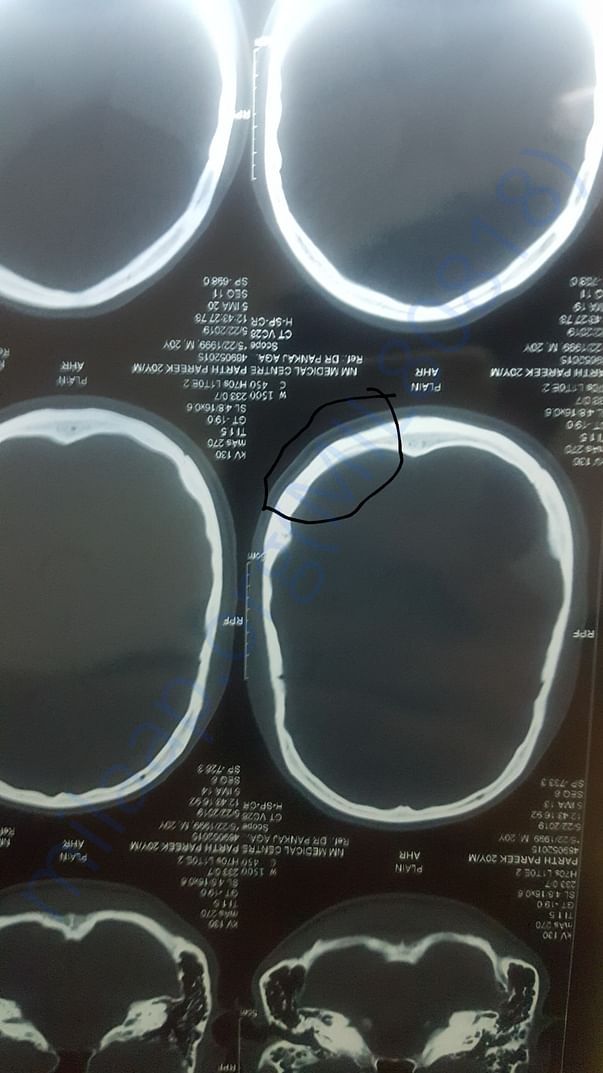 CT scan of injured part