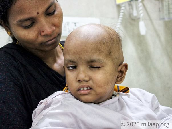 Help Ishan Fight Brain Tumor