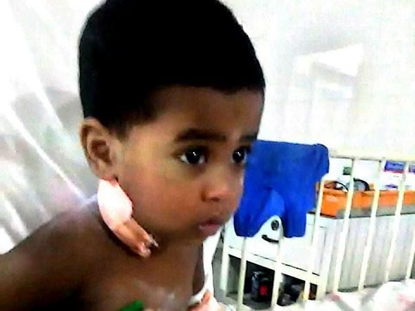 Help Jaswanth From Cancer