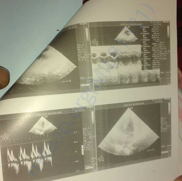 Medical Bill