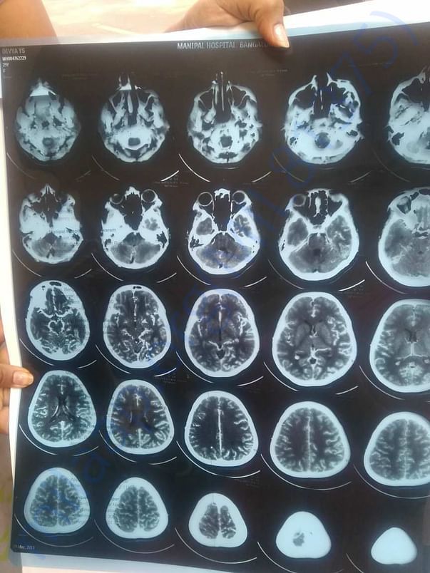 Xray report