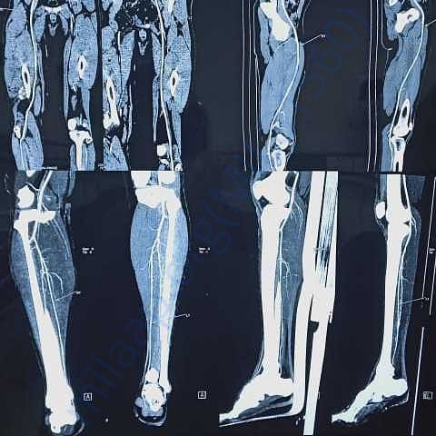 Medical Report