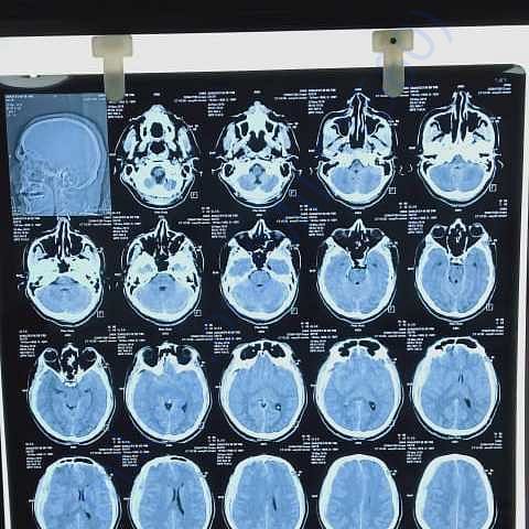 Medical Report