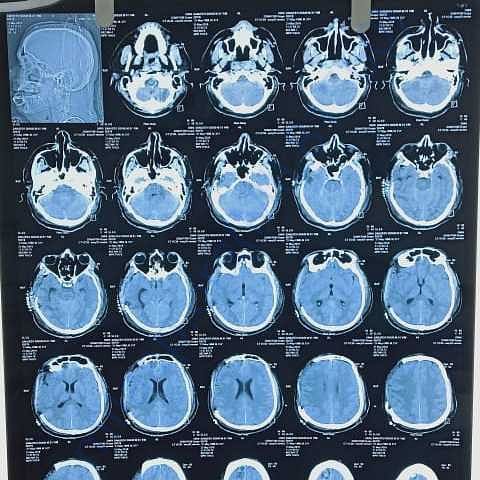 Medical Report
