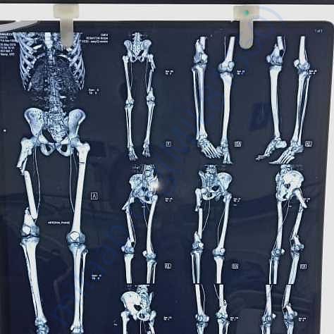 Medical Report