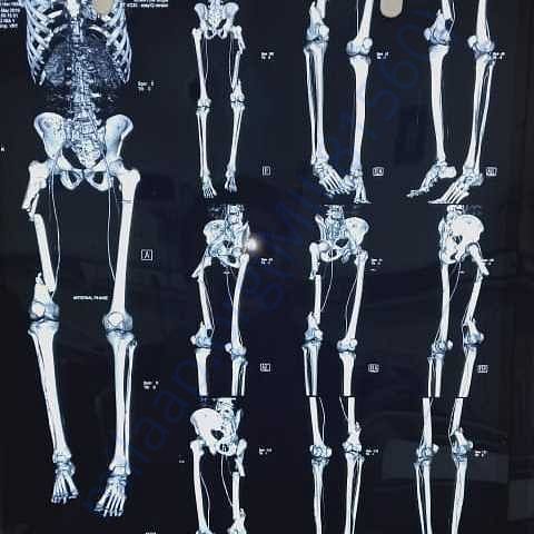 Medical Report