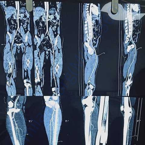 Medical Report