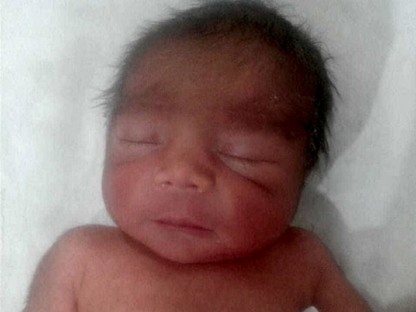Support Premature Baby Born at 28 Weeks