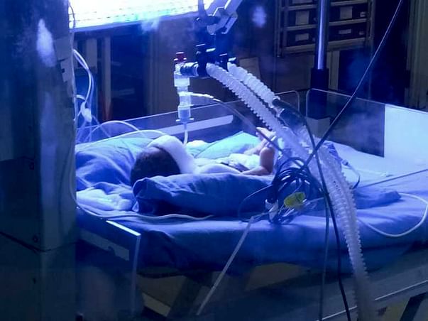 Help my premature baby