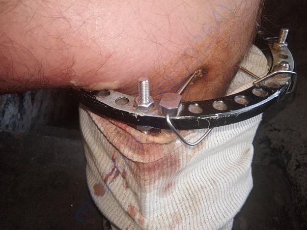 Leg image which is operate