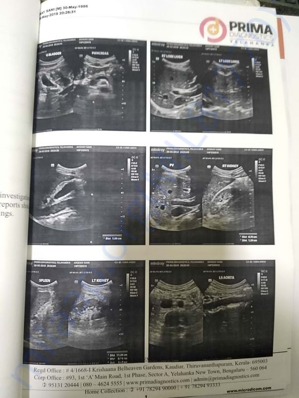 Xray report