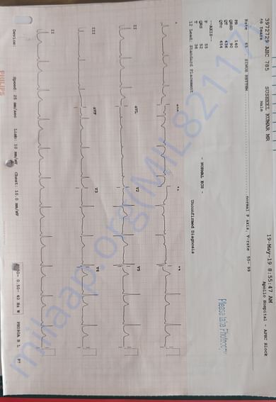 Apollo Hospitals, Chennai reports