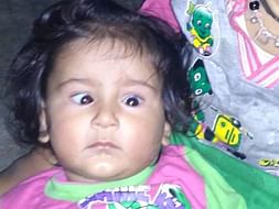 Please help Baby with squint eyes!