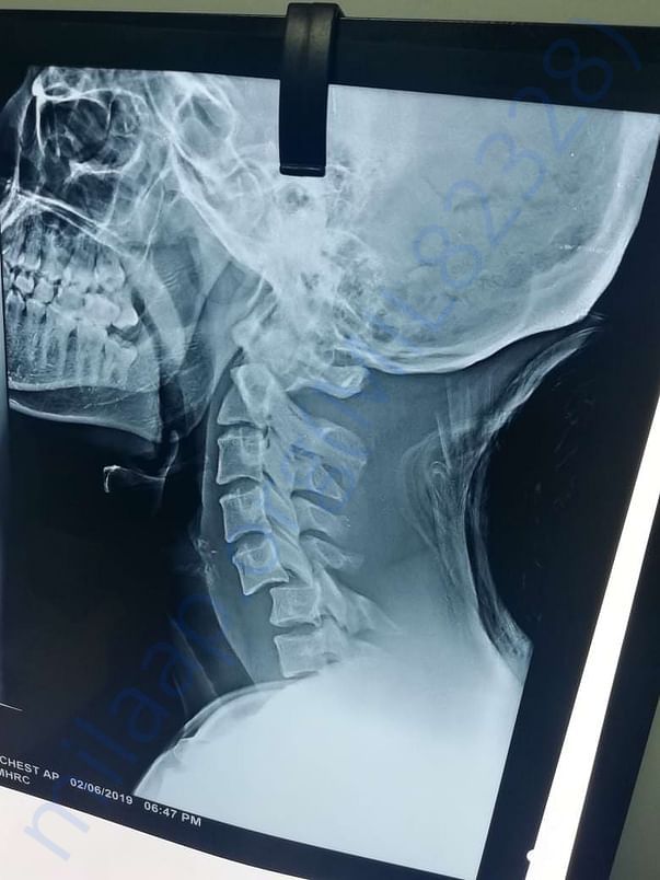 Medical scan