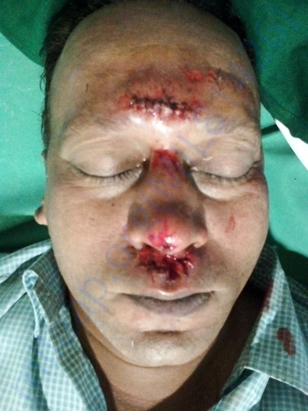 Help Ajay to meet medical expenses
