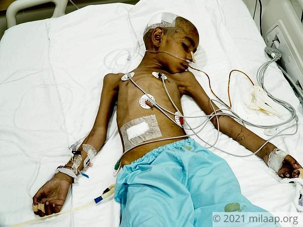 Shivam Singh needs your help to undergo his treatment