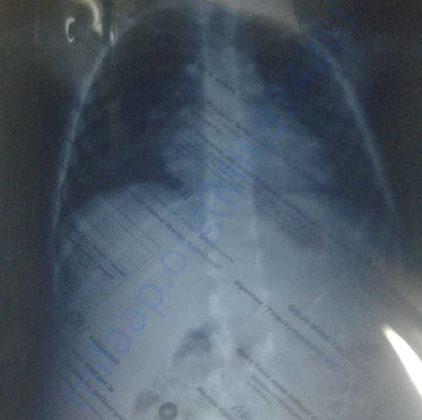 Medical Report