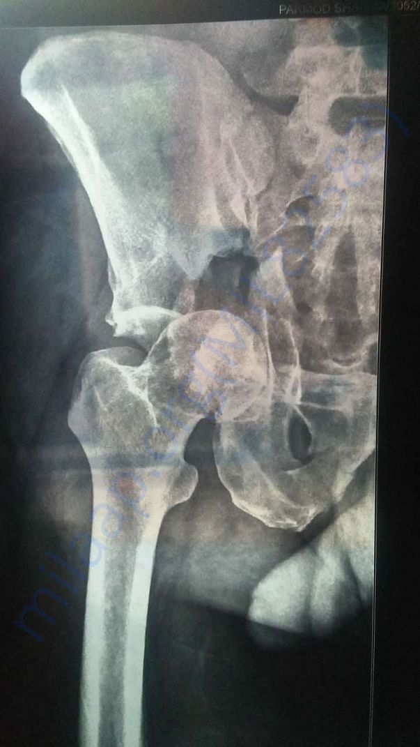 Xray report