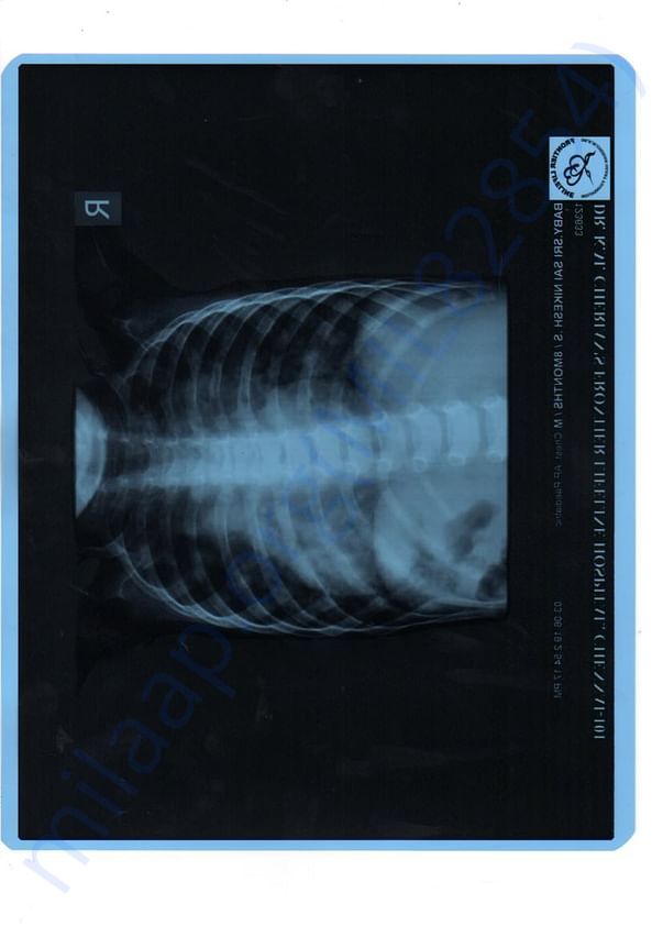 Xray report
